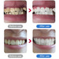 🦷✨ Scala dentale a ultrasuoni elettrica per la rimozione del tartaro e della placca